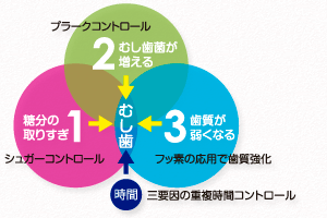 三つの要因でむし歯ができる